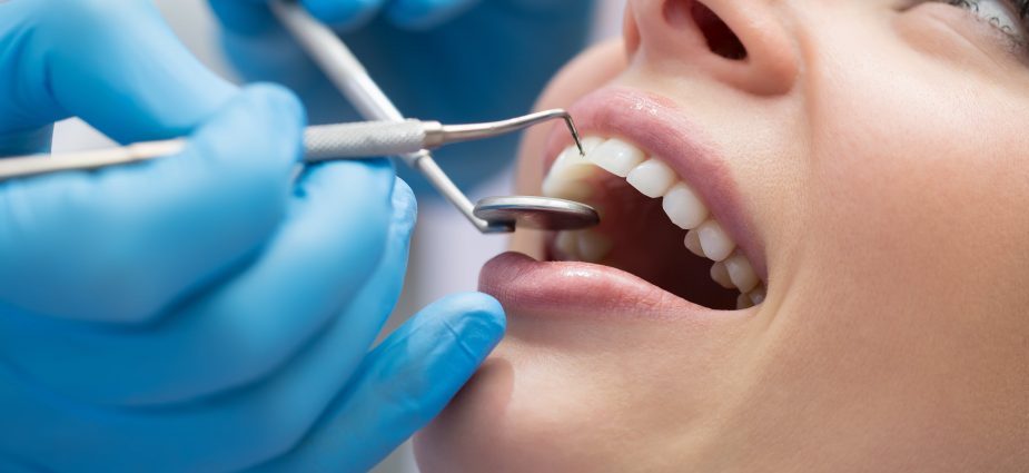 dental treatments