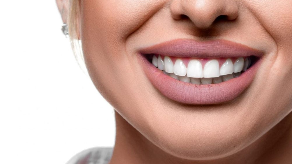 tooth whitening